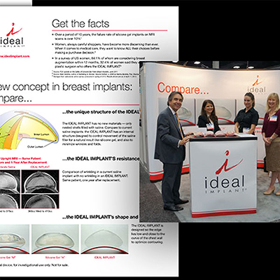 Ideal Implant booth 